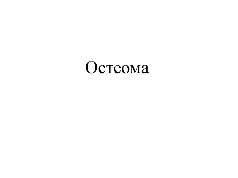 Остеома